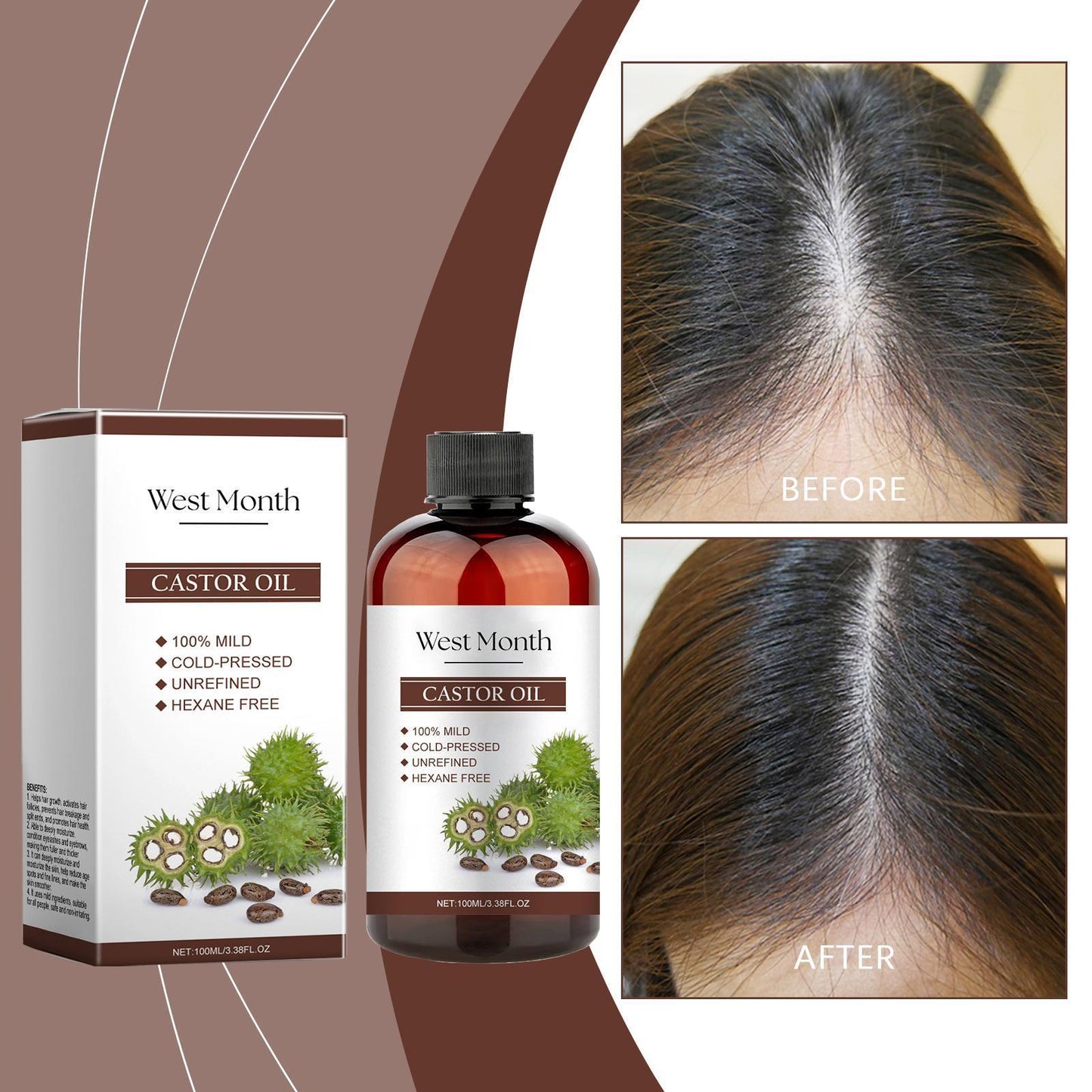 Xiyue All-in-one Castor Oil Is An Essential Oil For Multi-effect Care, Moisturizing Skin, Eyelashes And Eyebrows